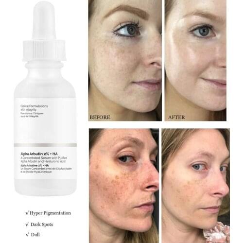 Alpha Arbutin 2%+HA Serum Moisturizing Brightening Fades Fine Lines and Spots Facial Essence Face Skin 30ML