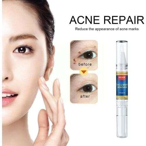 Skin beauty mole removal pen Repair No Trace Beauty Liquid Pen Mole Treatment Skin Papilloma Warts Removal Of F7D3