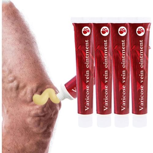 Varicose Veins Treatment Cream Effective cure Vasculitis Phlebitis Spider Veins Pain Varicosity Angiitis ointment Health Care