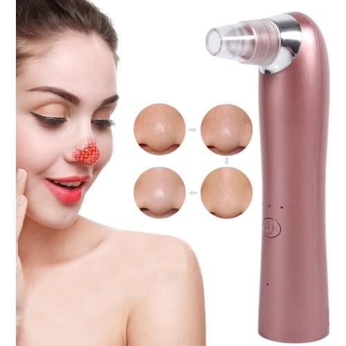 Blackhead Remover Pore Vacuum Cleaner Rechargeable Face Vacuum Comedone Extractor Tool for Blackhead Whitehead Acne Removal