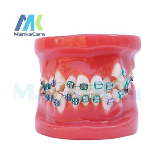 Manka Care - 28 pcs Tooth, half metal&half ceramic bracket Oral Model Teeth Tooth Model