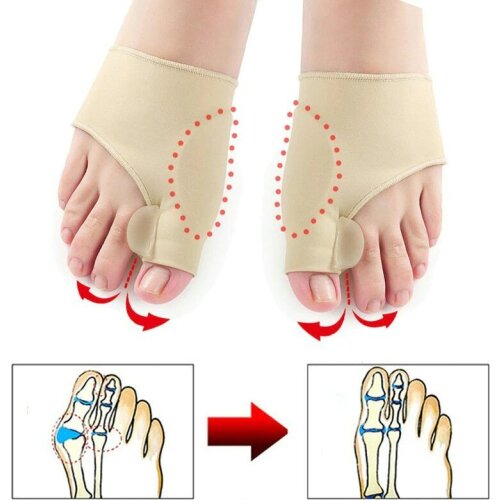 2Pcs Silicone Gel Bunion Thumb Corrector Toe Separator Stretch Hallux Valgus Protector Finger Straightener Orthopedic Protector