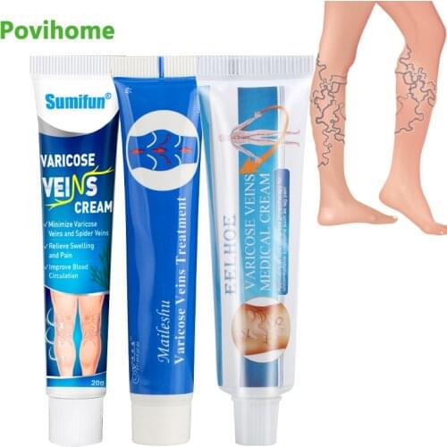 3Types Varicose Vein Treatment Cream Vasculitis Phlebitis Ointment Varicosity Angiitis Thigh Spider Removal Pain Relief Plaster