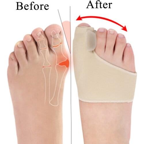 1Pair Big Bone Orthopedic Bunion Orthosis Pedicure Socks Silicone Hallux Valgus Corrector Braces Toes Separator Feet Care
