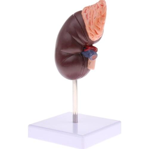 Kidney Anatomy Model 1:1 Human Removable 2 Parts Kidney with Adrenal Gland Anatomical Model Teaching Demonstration Supplies