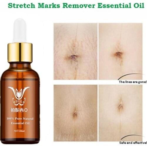 30ML Stretch Marks Essential Oil Skin Care Treatment Cream For Stretch Mark Removal Maternity Slackline For Pregnant Oils