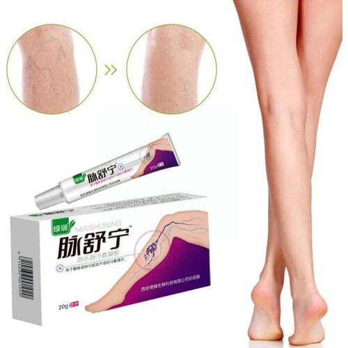 New Varicose Veins Treatment Cream Natural Original Medical Plaster Spider Phlebitis Ointment Relief Pain Vasculitis C6L6