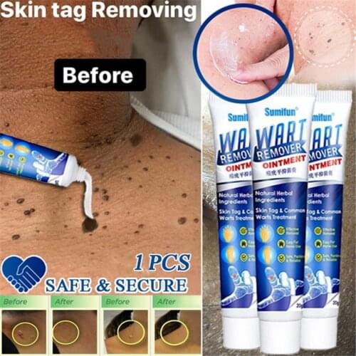 Sumifun Wart Remover Skin Tag Remover Ointment 12 hours Tu kill Medical Tu kill Remover Skin Tag Mole & Genital Wart Remover