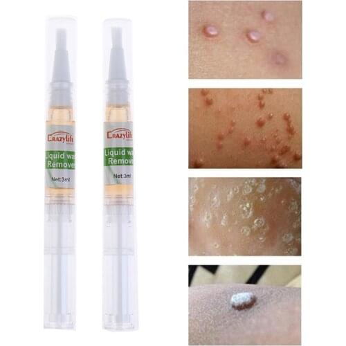 2Pcs 5 Days Skin Tag Remover Pen Natural Health Mole Nevus Wart Skin Tag Removal 3ML