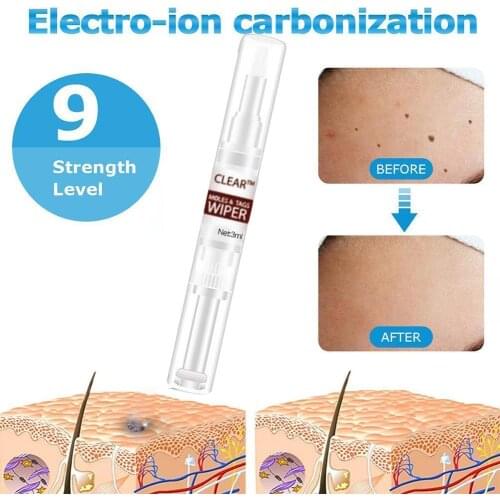 Genital Wart Treatment Papillomas Removal Of Warts Liquid From Skin Tags Removing Against Moles Remover Wart Removal Liquid Tool