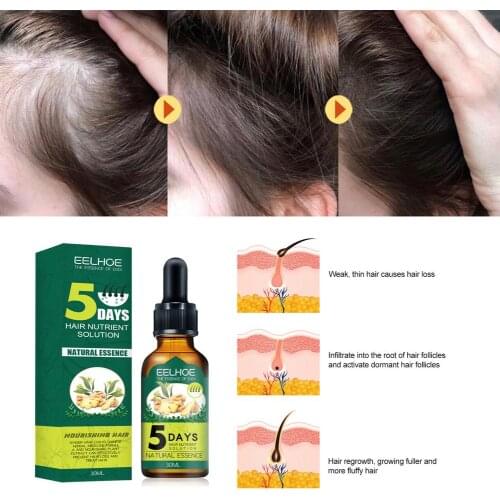 30ml Ginger Hair Care Essential Oil Hair Growth Care Essence Growth Anti-hair Loss Essence (Boxed)