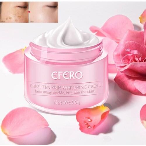 EFERO Whitening Face Cream Freckle Cream Remove Dark Spots Sunburn Melanin Brighten Smooth Shrink Pores Moisturizing Skin Care