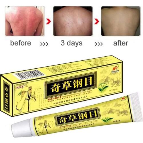 100pcs QICAOGANGMU Focallure Skin Psoriasis Cream Dermatitis Eczematoid Ointment Treatment Psoriasis Cream YIGANERJING