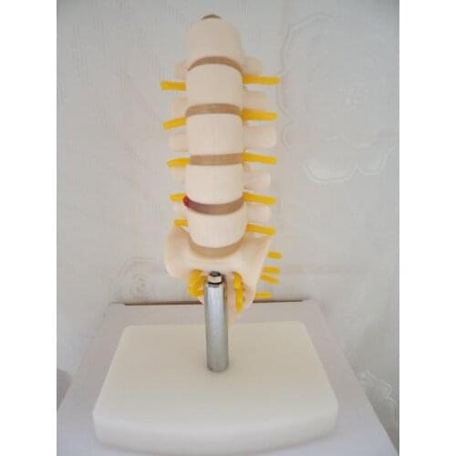 15CM Height Human Lumbar Model Spine Small Five Lumbar Spine Model with Coccyx Model Lumbar Bone Lesions Model Teaching Supplies