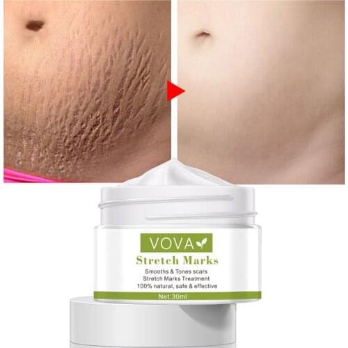 Effective Remove Pregnancy Scars Acne Cream Stretch Marks Treatment Maternity Repair Anti-Aging Anti-Winkles Firming Body Creams