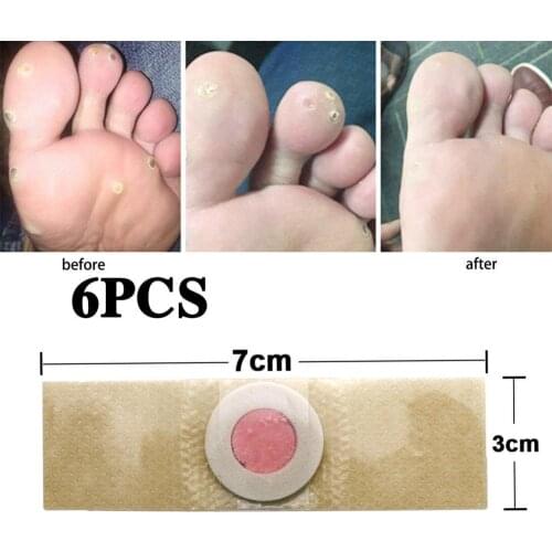 Hard Callus Removal Care Patch Hand And Foot Calluses Foot Pads Easy Detoxification Foot Patch