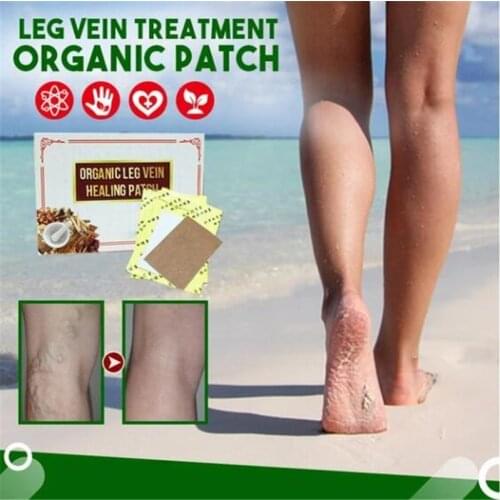 6 Patches Spider Veins Varicose Treatment Plaster Varicose Veins Cure Patch Vasculitis Natural Solution Herbal Patche