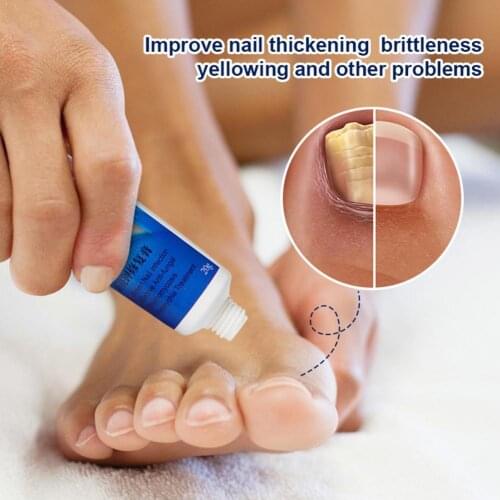 Кремы BIIZOECARE China At AliExpress