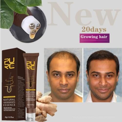 PURC New Hair Growth Products Fast Growing Oil Hair Loss Care Beauty Hair & Scalp Treatment for Men Women Baldness Treatment