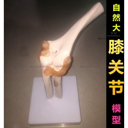 Medical plastic teaching model of human knee joint model with anadesma 1 to 1
