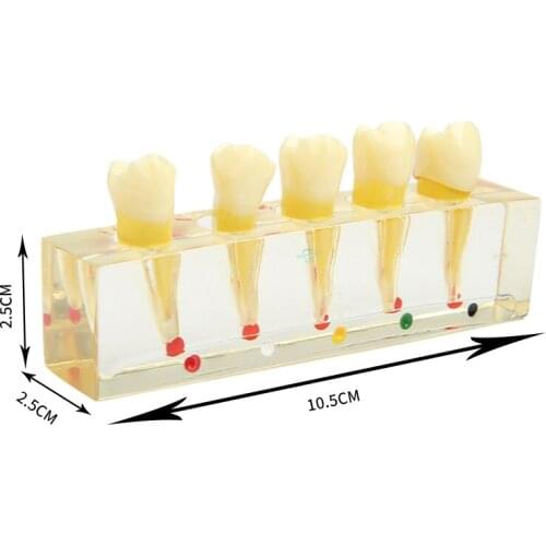 1pcs Dental Model Pulp Restoration Pathological Model with Detachable teeth Premolar teeth caries crown pulp cavity filling