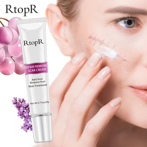 RtopR 20g Acne Scar Stretch Marks Remover Cream Skin Repair Face Cream Spots Acne Treatment Blackhead Whitening Cream Skin Care