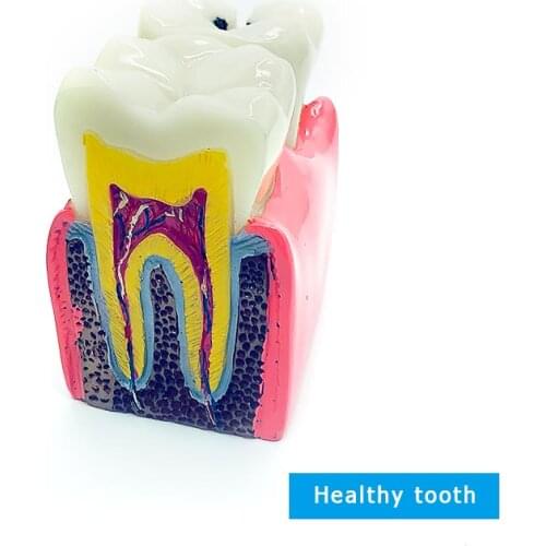 Dental Teeth Model Caries Model Teeth Dentist Dental Disease Teaching Model