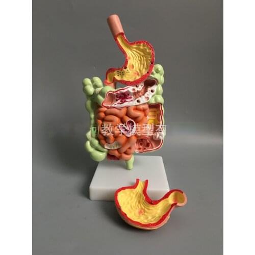 Human Digestive System Model Stomach Anatomy Large Intestine Cecum Rectum Duodenum Human Visceral Structure Biology Model