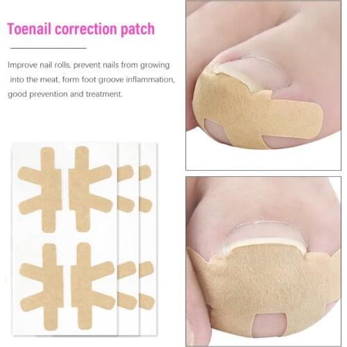 5 Pcs Ingrown Toenail Corrector Stickers Orthodontic Paronychia Treatment Recover Patches Toe Fingernail Foot Care Tool