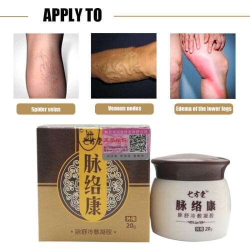 Varicose Veins Treatment Ointment Varicosity Angiitis Remedy Relief Veins Pain Phlebitis Legs Varicose Veins Cream Health Care