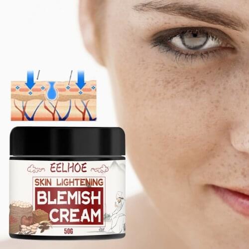 Powerful Whitening Cream Fade Spots Moisturizing Cream Lightening Freckle Removing Cream Skin Care Whitening Cream