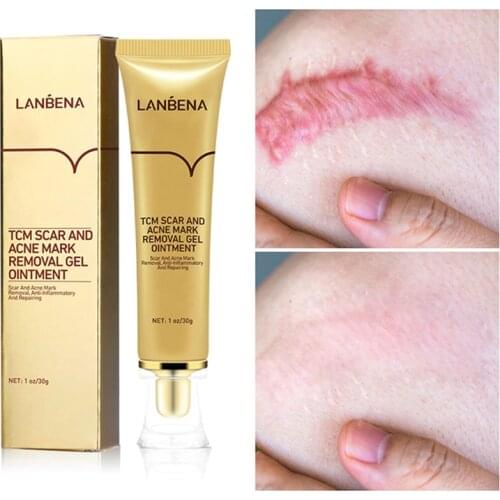 LANBENA Acne Scar Cream Weaken Pimple Marks Narrow Pores Curb Regeneration Of Pimples Scar And Acne Mark Removal Gel Oimtment