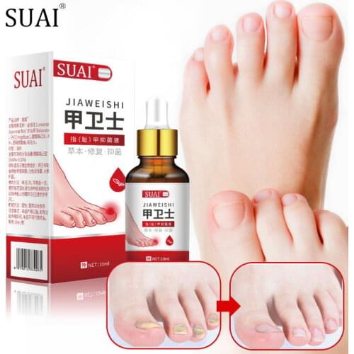 Nail Fungal Removal Essence Fungal Nail Treatment Serum Anti Infection Cure Paronychia Onychomycosis Toe Fungus Repair Feet Care