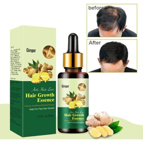 30ml Anti Hair Loss Serum for Dense Hair Growth Treatment Oil Hair Tonic Hair Care Hair Loss Liquid Hair Growth Serum