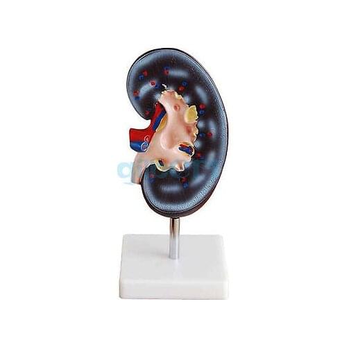 2X Life Size human Right kidney Anatomical Medical Model On the Base