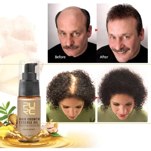 Hair Growth Products Fast Growing Hair Oil Hair Loss Care Spray Beauty Hair & Scalp Treatment for Men Women Hair Loss Prevent