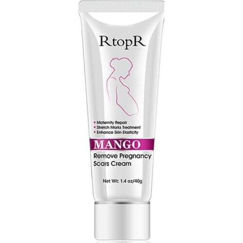 Mango Essence Gentle Non-stimulating Remove Pregnancy Cream Anti-winkles Marks Scars Cream Treatment Body Smoom Stretch Acn C7A9