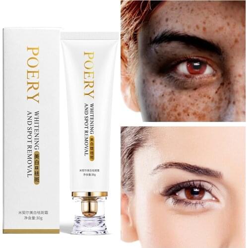 Whitening Freckle Cream Remove Melasma Acne Spot Pigment Melanin Dark Spots Pigmentation Moisturizing Skin Care Products