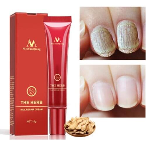 Natural Herb Nail Repair Cream Anti Remove Nail Onychomycosis Paronychia Promote Nail Growth Foot Cream Brighten Nail