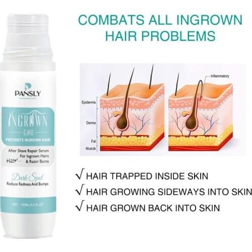 100ml Hair Removal Ball Essence Razor Bump Stopper Ingrown treatment After Shave Reduce Dark Spots Redness Razor Burns Solution