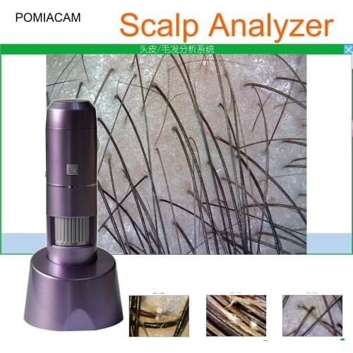 AI Smart Scalp Analyzer UV Hair Follicle Detector Hair Test Wireless WIFI Dandruff check Support Android Phone Apple