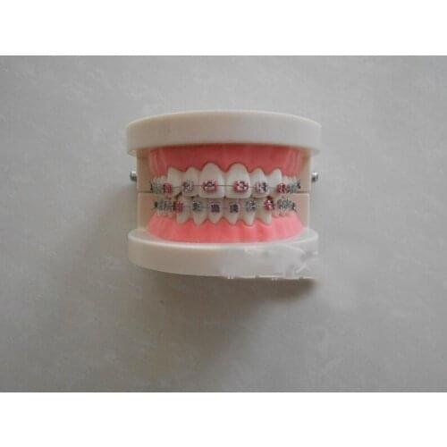 Correcting tooth dental tooth model Dental Orthodontic Tooth Model