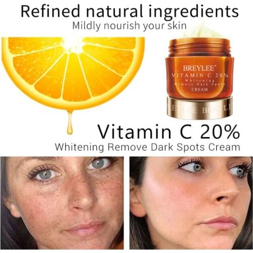 BREYLEE Whitening Cream Remove Dark Spots Dark Skin Bleaching Brighten Freckle Cream Fade Pigment Melanin Spots Whiten Skin Care