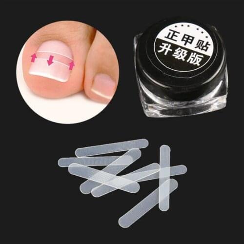 10pcs Ingrown Toenail Correction Tool Ingrown Toe Nail Treatment Elastic Patch Sticker Straightening Clip Brace Pedicure Tool