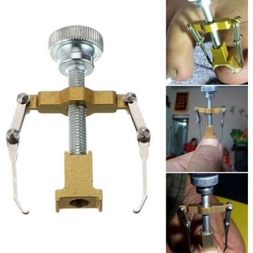 1Pc Ingrown Toe Nail Recover Tool Pedicure Toenail Onyxis Ingrowing With Fixer Foot Nail Corrector Bunion Box Nail Pedicure A7S3