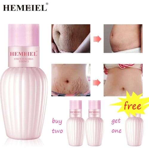 Крема от растяжек Hemeiel China At AliExpress