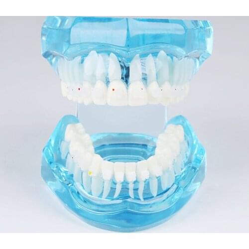 M3002 Orthodontic Demonstration Tooth Model with Ceramic Brackets Dental Teaching Model