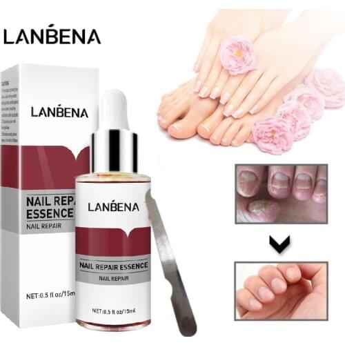 LANBENA Fungal Nail Treatment Feet Care Essence Removal Fungus Healthy Repair Serum Anti Infection Paronychia Onychomycosis
