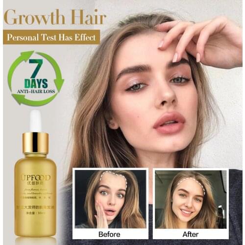 Hair Growth Essence Oil Anti Hair Loss Treatment for Hair Growth Hair Care Anti Preventing Hair Loss Products Hair Tonic Thick