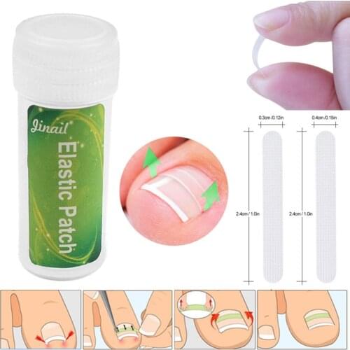 10pcs Ingrown Toenail Straightening Clip Correction Paronychia Curved Feet Care Tool Toenail Straightening Clip